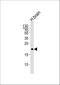 Hippocalcin antibody, A03907, Boster Biological Technology, Western Blot image 