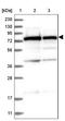 Signal Recognition Particle 72 antibody, NBP1-89498, Novus Biologicals, Western Blot image 