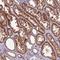 GEN1 Holliday Junction 5' Flap Endonuclease antibody, HPA021141, Atlas Antibodies, Immunohistochemistry frozen image 