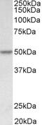 Far Upstream Element Binding Protein 1 antibody, 43-073, ProSci, Immunohistochemistry paraffin image 