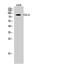 Chloride Voltage-Gated Channel 6 antibody, PA5-50934, Invitrogen Antibodies, Western Blot image 