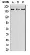 Adhesion G Protein-Coupled Receptor L2 antibody, MBS8211226, MyBioSource, Western Blot image 