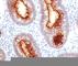Carcinoembryonic Antigen Related Cell Adhesion Molecule 5 antibody, V2375IHC-7ML, NSJ Bioreagents, Immunohistochemistry paraffin image 