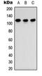 Teashirt Zinc Finger Homeobox 3 antibody, orb234975, Biorbyt, Western Blot image 