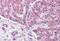 Peroxisome Proliferator Activated Receptor Alpha antibody, MBS240472, MyBioSource, Immunohistochemistry paraffin image 