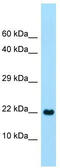 C-Type Lectin Domain Family 2 Member A antibody, TA334085, Origene, Western Blot image 