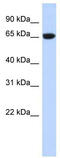 GTP Binding Protein 2 antibody, TA344162, Origene, Western Blot image 