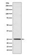 Triosephosphate Isomerase 1 antibody, M02559, Boster Biological Technology, Western Blot image 