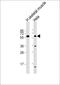 Solute Carrier Family 29 Member 2 antibody, M04718, Boster Biological Technology, Western Blot image 