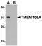 Transmembrane protein 106A antibody, orb75773, Biorbyt, Western Blot image 