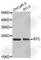 Probetacellulin antibody, A2588, ABclonal Technology, Western Blot image 