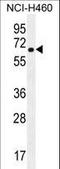 Cholinergic Receptor Nicotinic Delta Subunit antibody, LS-C168757, Lifespan Biosciences, Western Blot image 