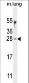 Ornithine Decarboxylase Antizyme 2 antibody, LS-C163095, Lifespan Biosciences, Western Blot image 