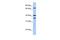 Transglutaminase 5 antibody, GTX46111, GeneTex, Western Blot image 