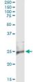 RASD Family Member 2 antibody, H00023551-M02, Novus Biologicals, Immunoprecipitation image 