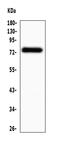 Mitochondrial Antiviral Signaling Protein antibody, A00169-1, Boster Biological Technology, Western Blot image 