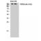 DNA Topoisomerase II Alpha antibody, LS-C386477, Lifespan Biosciences, Western Blot image 
