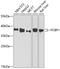 Poly(RC) Binding Protein 1 antibody, GTX64891, GeneTex, Western Blot image 