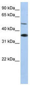 Rh Family B Glycoprotein (Gene/Pseudogene) antibody, TA338417, Origene, Western Blot image 