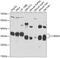 Cytochrome B5 Reductase 3 antibody, 23-012, ProSci, Western Blot image 