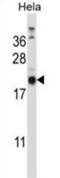 Proline Rich And Gla Domain 1 antibody, abx027358, Abbexa, Western Blot image 