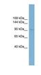 Filamin A Interacting Protein 1 Like antibody, NBP1-70759, Novus Biologicals, Western Blot image 