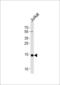 Ubiquitin Conjugating Enzyme E2 D4 (Putative) antibody, LS-C157309, Lifespan Biosciences, Western Blot image 