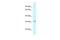 Lysine Methyltransferase 5B antibody, PA5-69767, Invitrogen Antibodies, Western Blot image 