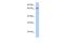 Zinc Finger Protein 676 antibody, A17142, Boster Biological Technology, Western Blot image 