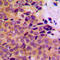 Matrix Metallopeptidase 8 antibody, LS-C352524, Lifespan Biosciences, Immunohistochemistry paraffin image 