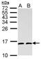 Small Nuclear Ribonucleoprotein 13 antibody, NBP1-32732, Novus Biologicals, Western Blot image 