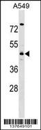 Tropomodulin 4 antibody, 59-326, ProSci, Western Blot image 