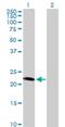 Leucine Rich Repeat Containing 29 antibody, H00026231-B01P, Novus Biologicals, Western Blot image 