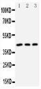 Death Associated Protein Kinase 2 antibody, PA1558, Boster Biological Technology, Western Blot image 