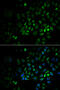 Glycosylphosphatidylinositol Specific Phospholipase D1 antibody, MBS129906, MyBioSource, Immunofluorescence image 