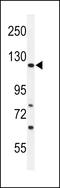 Rho GTPase Activating Protein 30 antibody, LS-C156472, Lifespan Biosciences, Western Blot image 