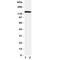 Collagen Type II Alpha 1 Chain antibody, R31260, NSJ Bioreagents, Western Blot image 