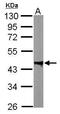 Protein Phosphatase, Mg2+/Mn2+ Dependent 1A antibody, GTX109744, GeneTex, Western Blot image 