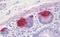 Regenerating Family Member 3 Gamma antibody, MBS248203, MyBioSource, Immunohistochemistry paraffin image 