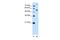 Phosphoribosyl Pyrophosphate Amidotransferase antibody, PA5-42813, Invitrogen Antibodies, Western Blot image 