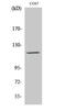 Protein Tyrosine Kinase 2 Beta antibody, STJ95277, St John