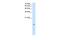 Microsomal Glutathione S-Transferase 2 antibody, PA5-42714, Invitrogen Antibodies, Western Blot image 