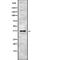 PIN2 (TERF1) Interacting Telomerase Inhibitor 1 antibody, abx217779, Abbexa, Western Blot image 