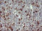 Matrix Metallopeptidase 13 antibody, LS-C338162, Lifespan Biosciences, Immunohistochemistry frozen image 