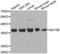 Methionine Adenosyltransferase 2B antibody, LS-C332561, Lifespan Biosciences, Western Blot image 