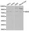 NIMA Related Kinase 8 antibody, MBS126251, MyBioSource, Western Blot image 