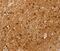 SSX Family Member 4B antibody, PA5-50833, Invitrogen Antibodies, Immunohistochemistry frozen image 
