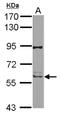 Receptor Interacting Serine/Threonine Kinase 2 antibody, NBP2-20167, Novus Biologicals, Western Blot image 