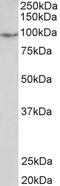 Phosphodiesterase 4B antibody, STJ70005, St John