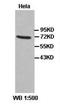 Epiregulin antibody, orb77127, Biorbyt, Western Blot image 